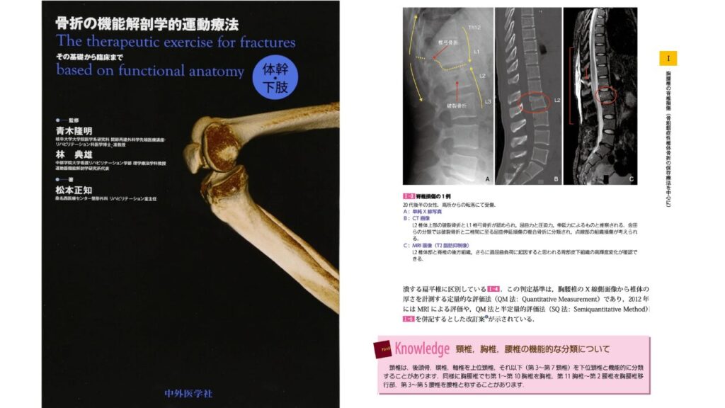骨折の機能解剖学的運動療法