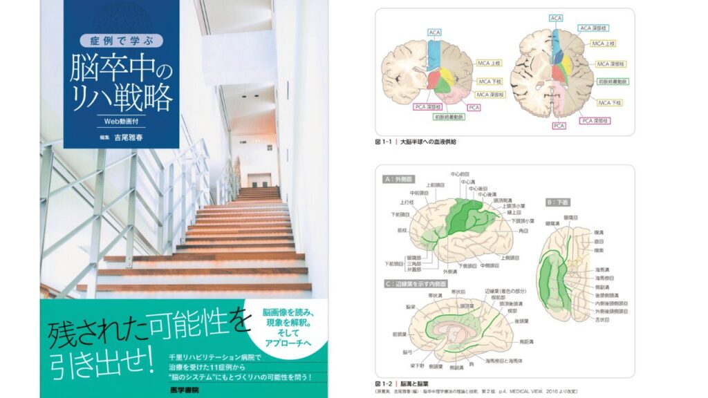症例で学ぶ脳卒中のリハ戦略