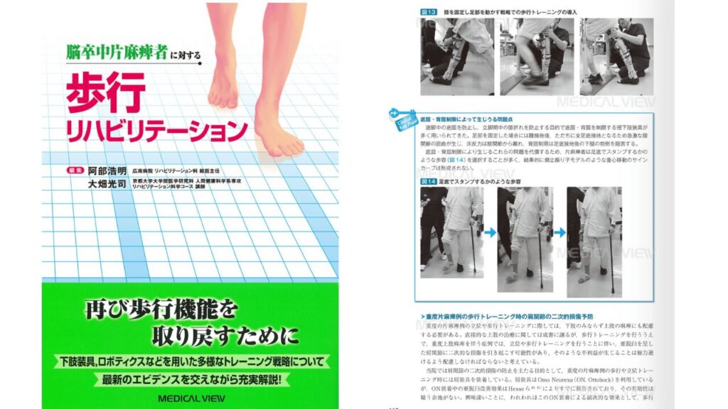 脳卒中片麻痺者に対する歩行リハビリテーション